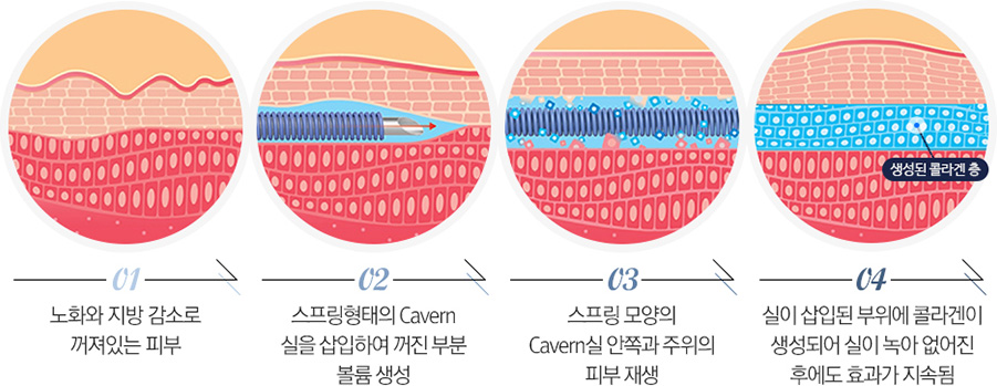 천안피부과-신부동피부과 아름다워지는 뷰티 시크릿 천안피부과 미앤미